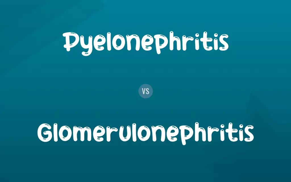 Pyelonephritis vs. Glomerulonephritis